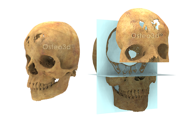 Online Surgical Planning