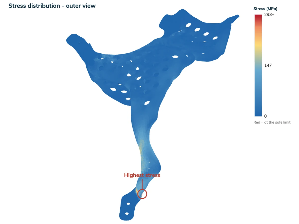 Stress distribution across a titanium implant, peak marked at the strut root