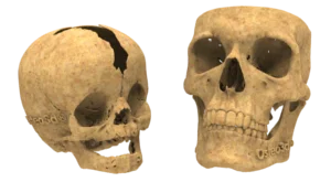 Patient-specific anatomical model